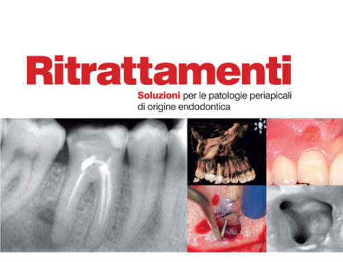 Endodonzia chirurgica